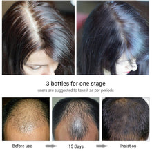 Load image into Gallery viewer, Ginseng Ginger Hair Growth Serum