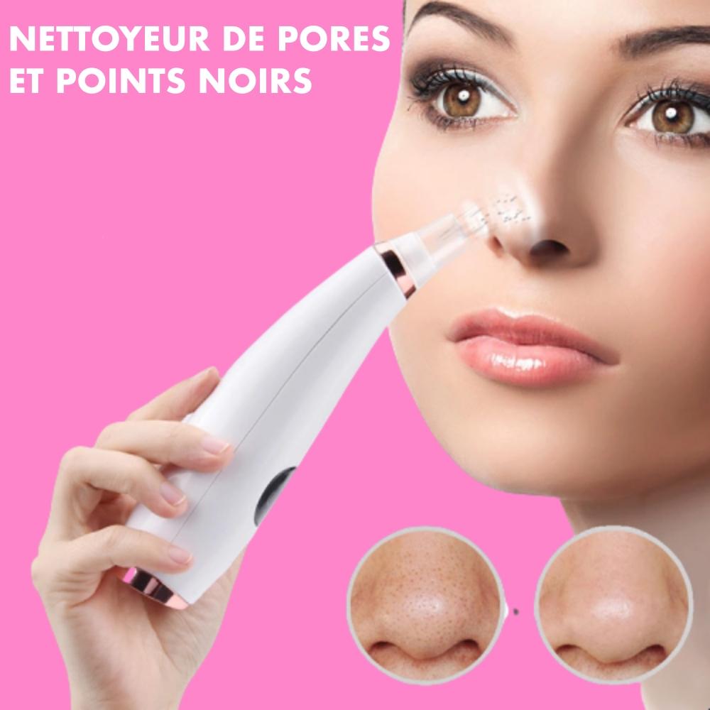 Pore and blackhead remover